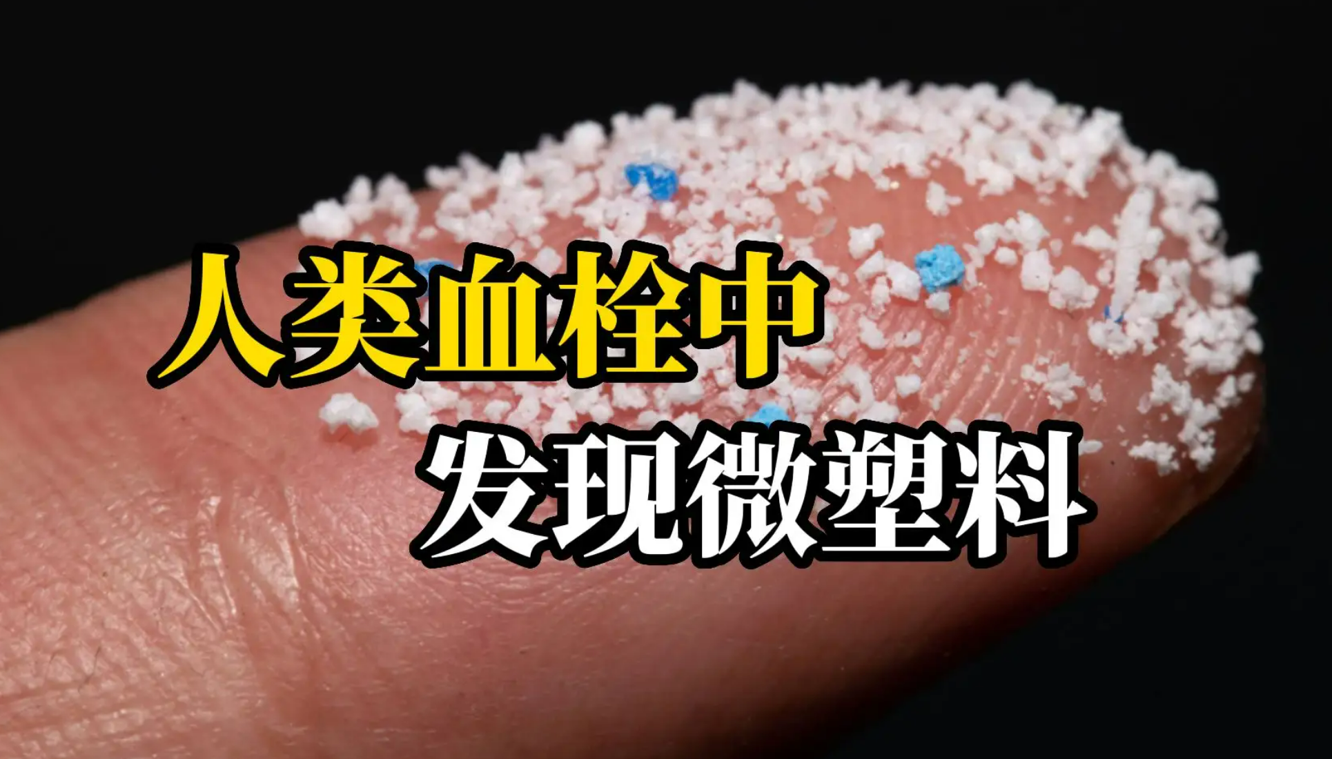 震驚！人類血栓中首（shǒu）次（cì）發現微塑料！